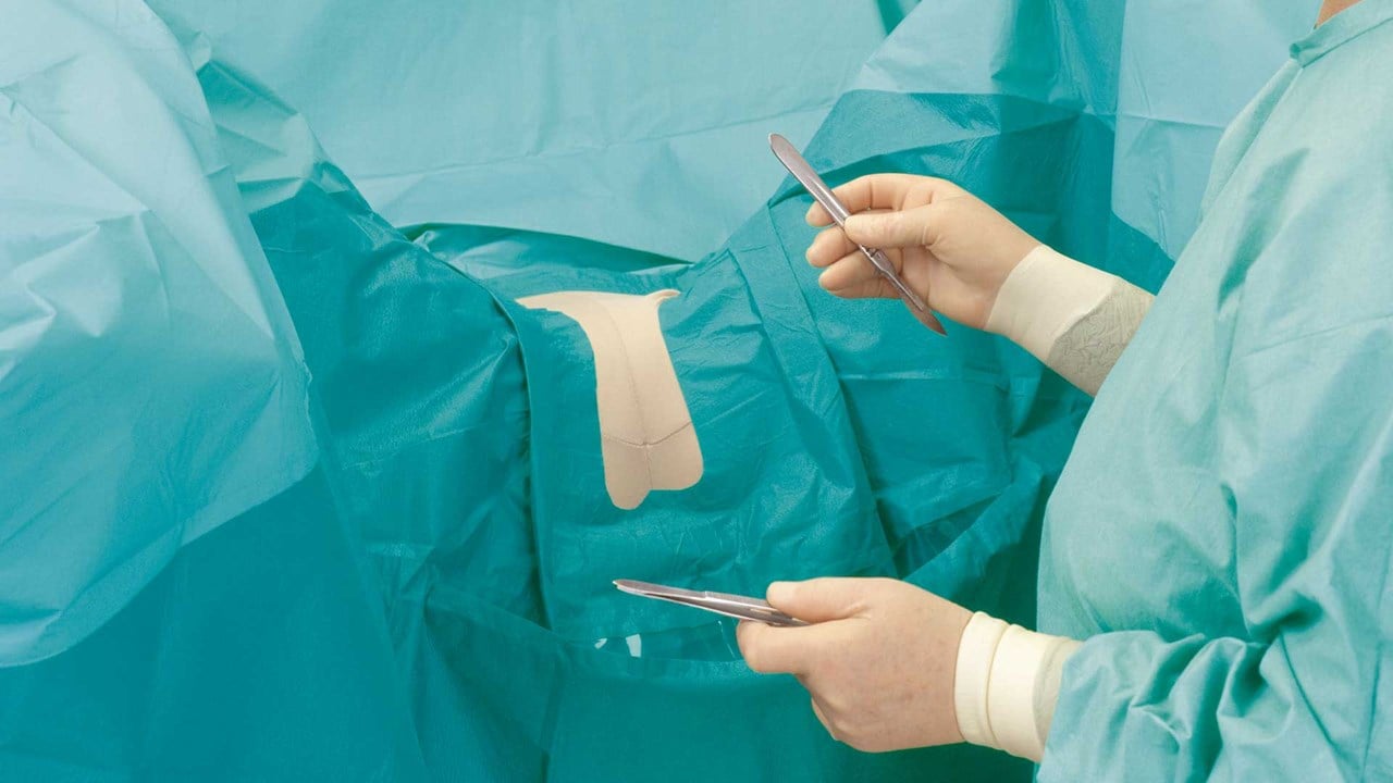 en kirurg med ett BARRIER gynekologilakan under ett ingrepp