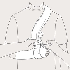 Step 1 of arm support with Collar'n'Cuff